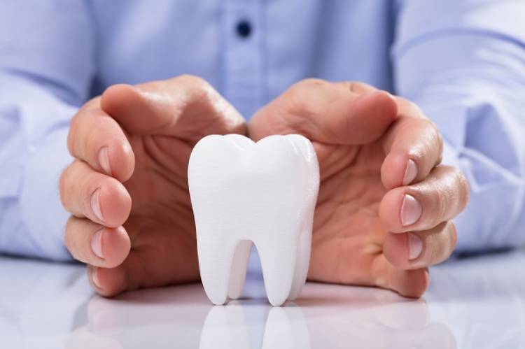 Does Insurance Cover Dental Bonding?